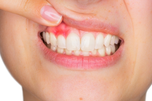 Bute Dentall Family - Clinica stomatologica, Bucuresti